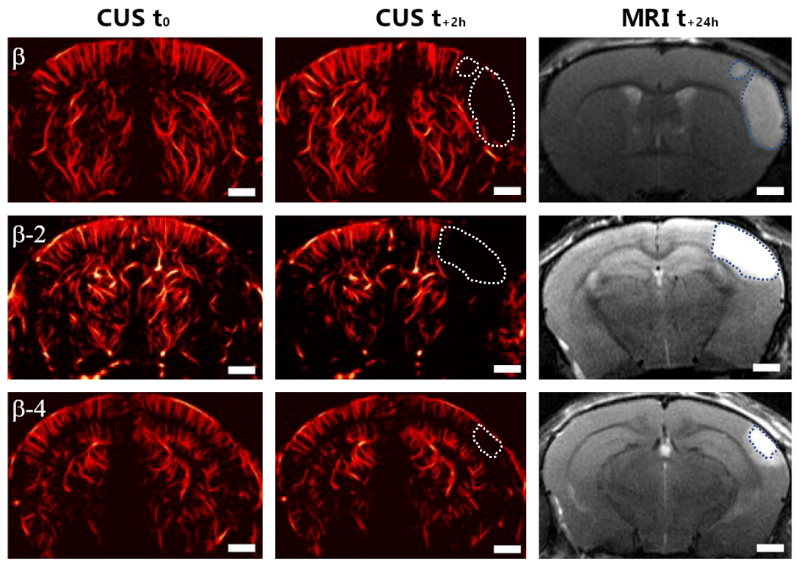 A first co-publication from PhIND and STROK@LLIANCE – image news