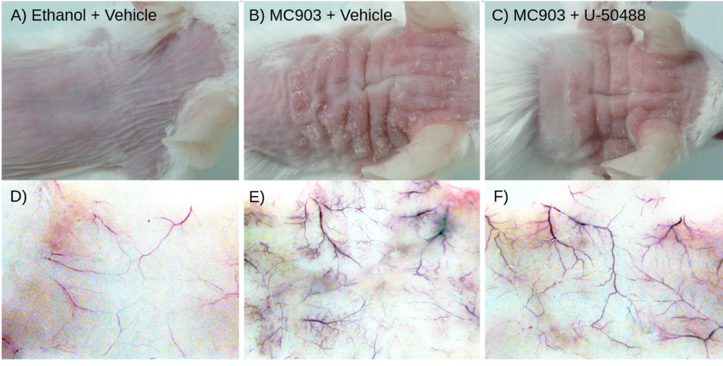 Photographs of the external and internal appearance of the skin