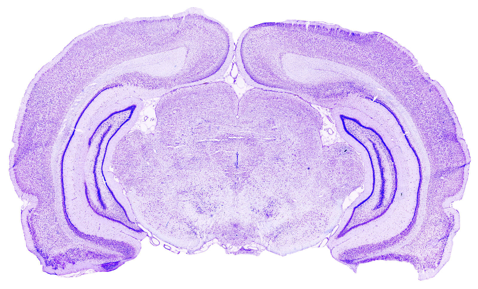 Neurology & CNS – cffafdcdeddaabc