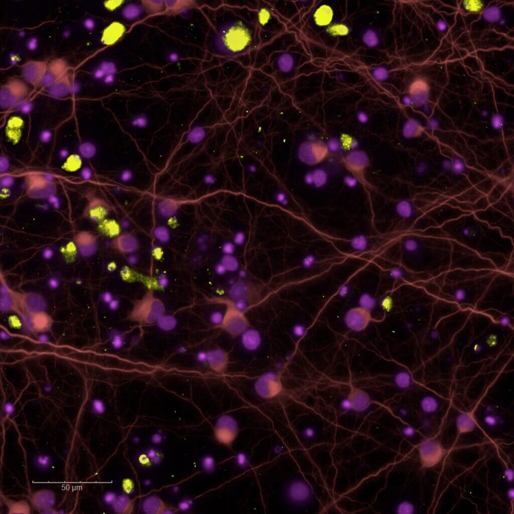 in vitro result of Apoptosis of neurons