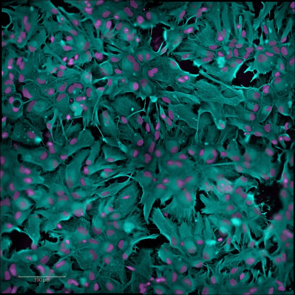 in vitro-Astrocytes-hiPSC-GFAP-and-DAPI-neuroinflammation-Alzheimer model
