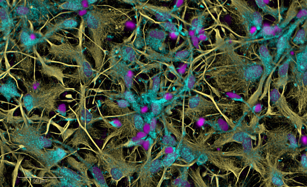 Working with us – etl se effi invitro astrocytes derivies hipscs actives par traitement cytokines marquage gfap nfkb dapi modele neuroinfl cytokines