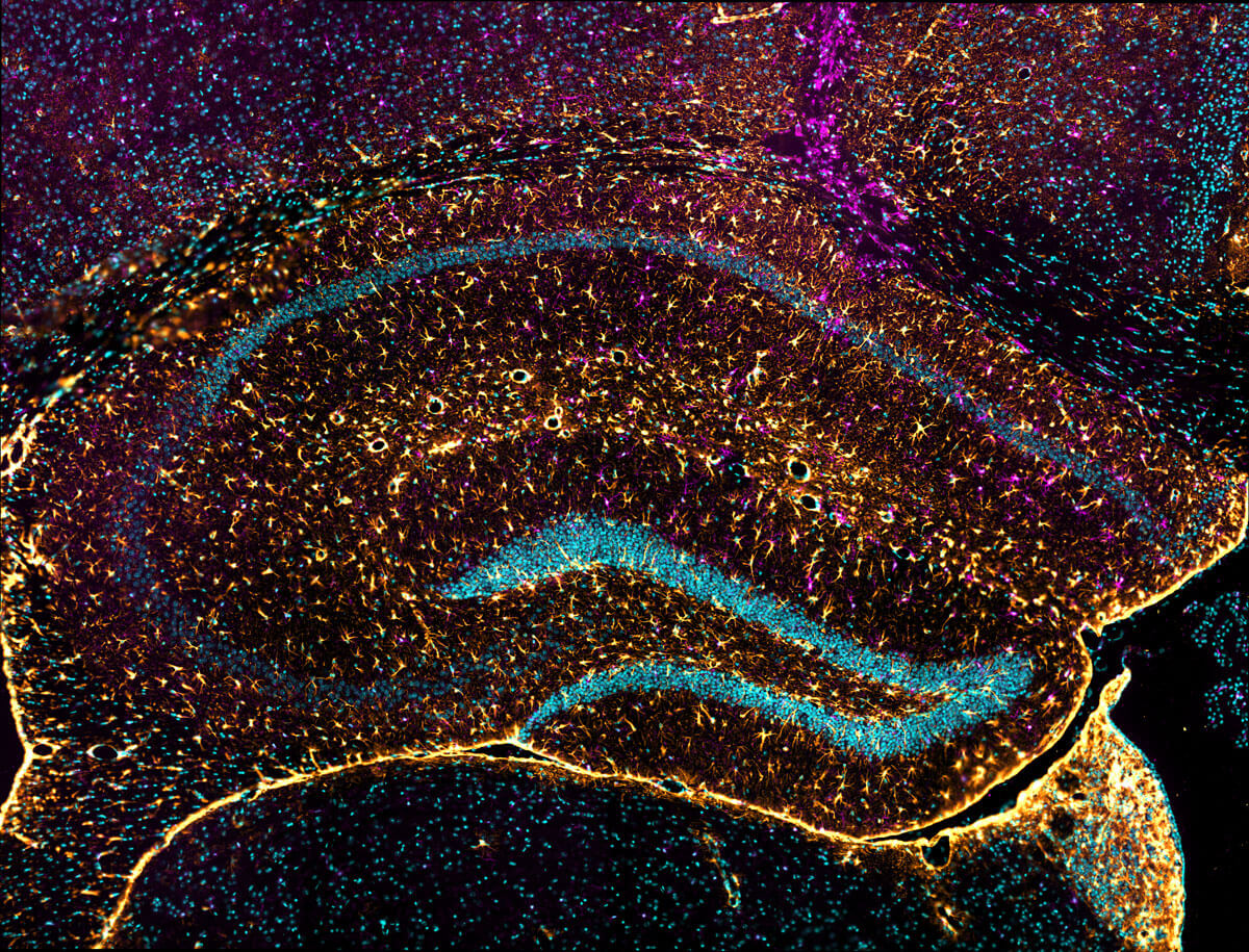 Working with us – etl se serv analyt microscopy analytic lab vivo alzheimer tau fluorescence