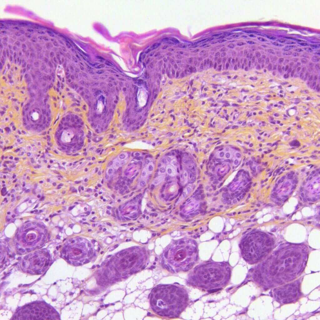 in vivo -maladie-inflam-Histo-peau-souris-psoriatique-HES-x20