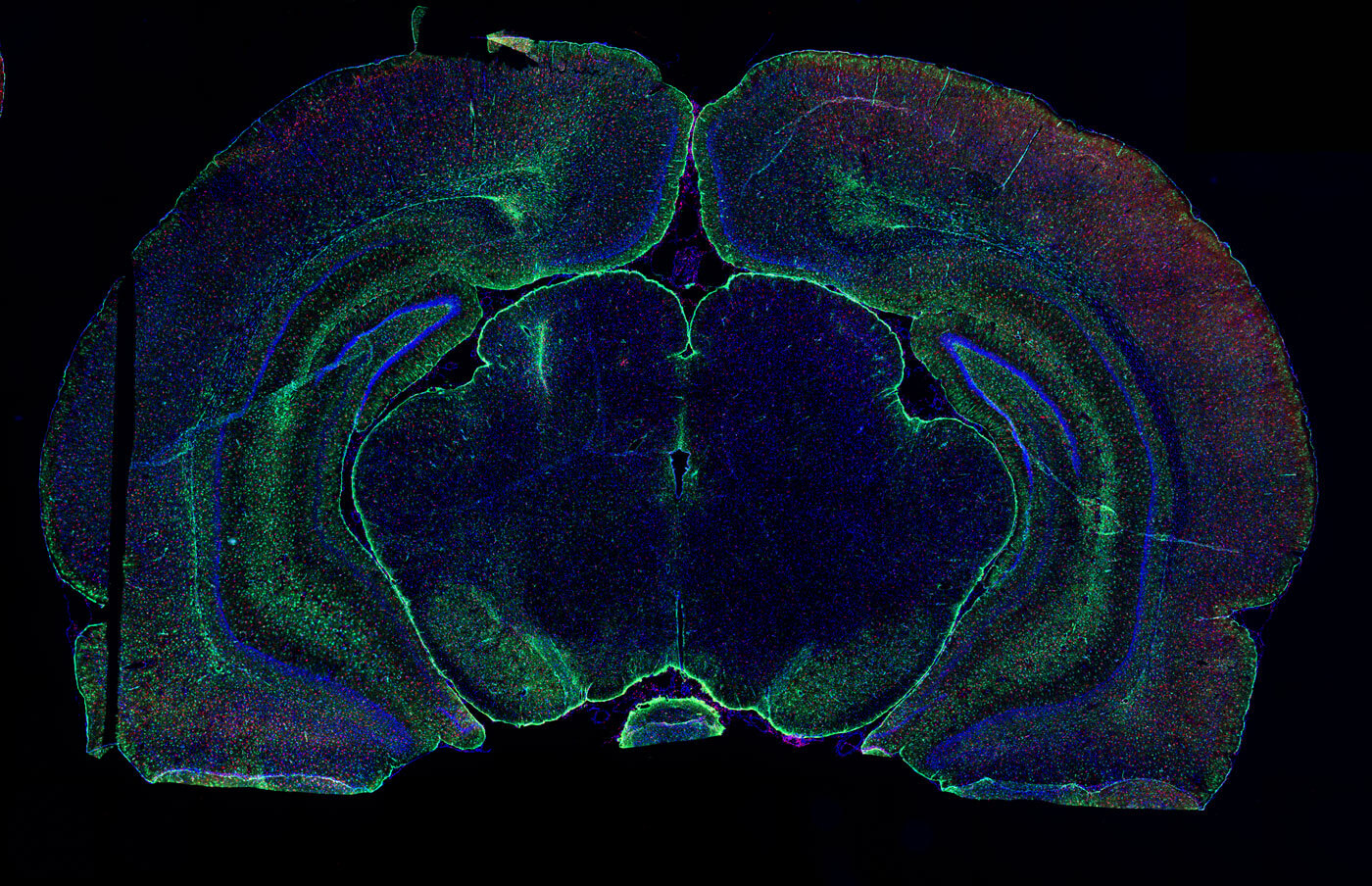 Newsletter – bonus vivo parkinson ohda fluorescence microglia astrocyte neuroinflammation whole brain red green blue