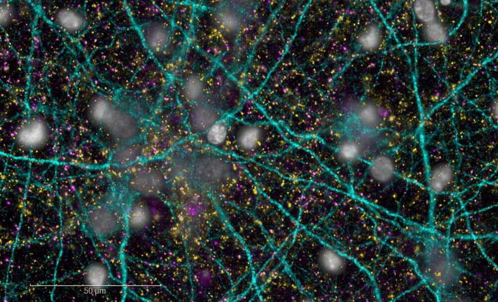 in vitro-Neurons-MAP2+Bassoon+PSD95+DAPI-Neurodegeneration model AB