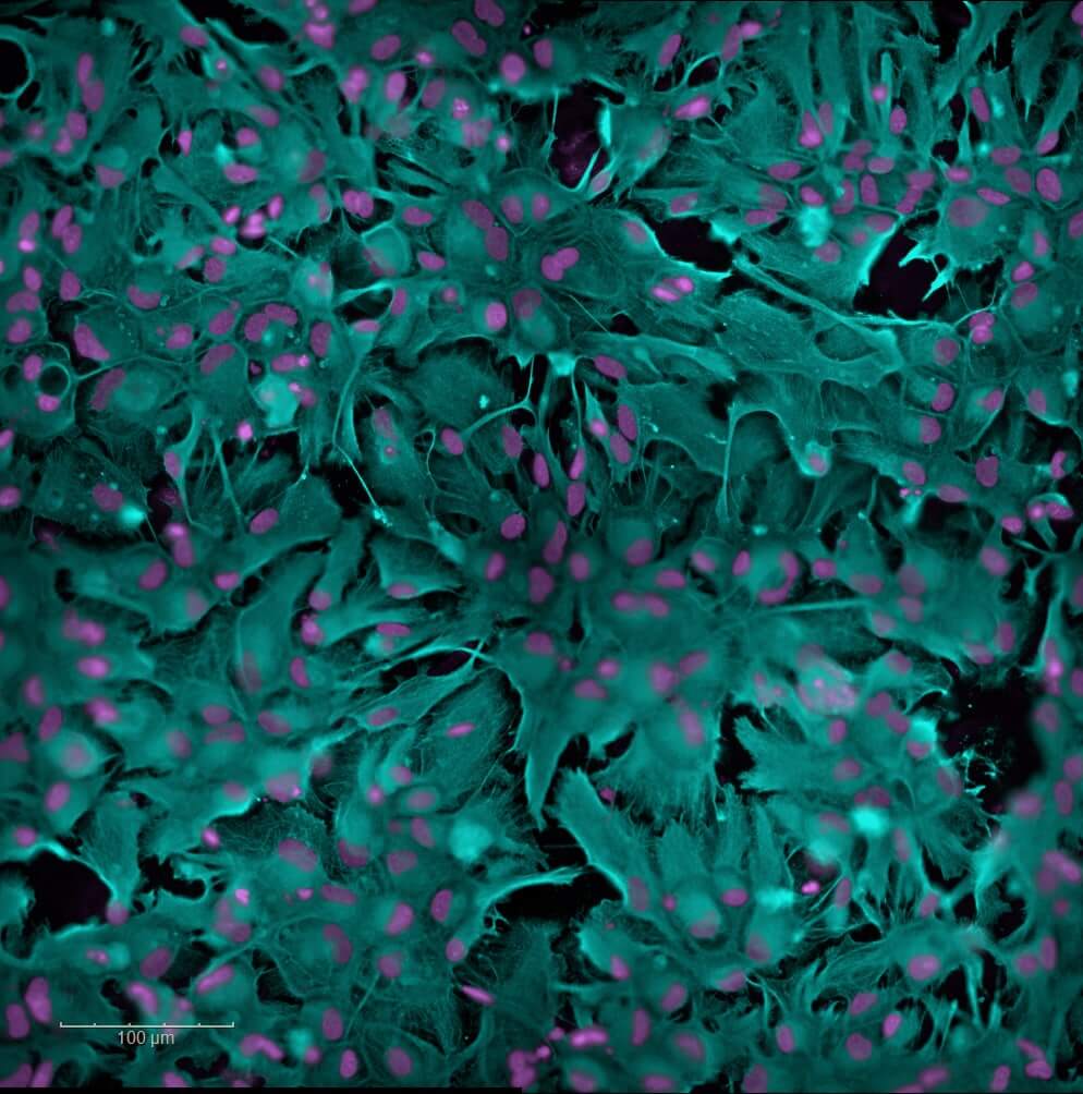 in vitro-Astrocytes-hiPSC-GFAP-and-DAPI-neuroinflammation-Alzheimer model