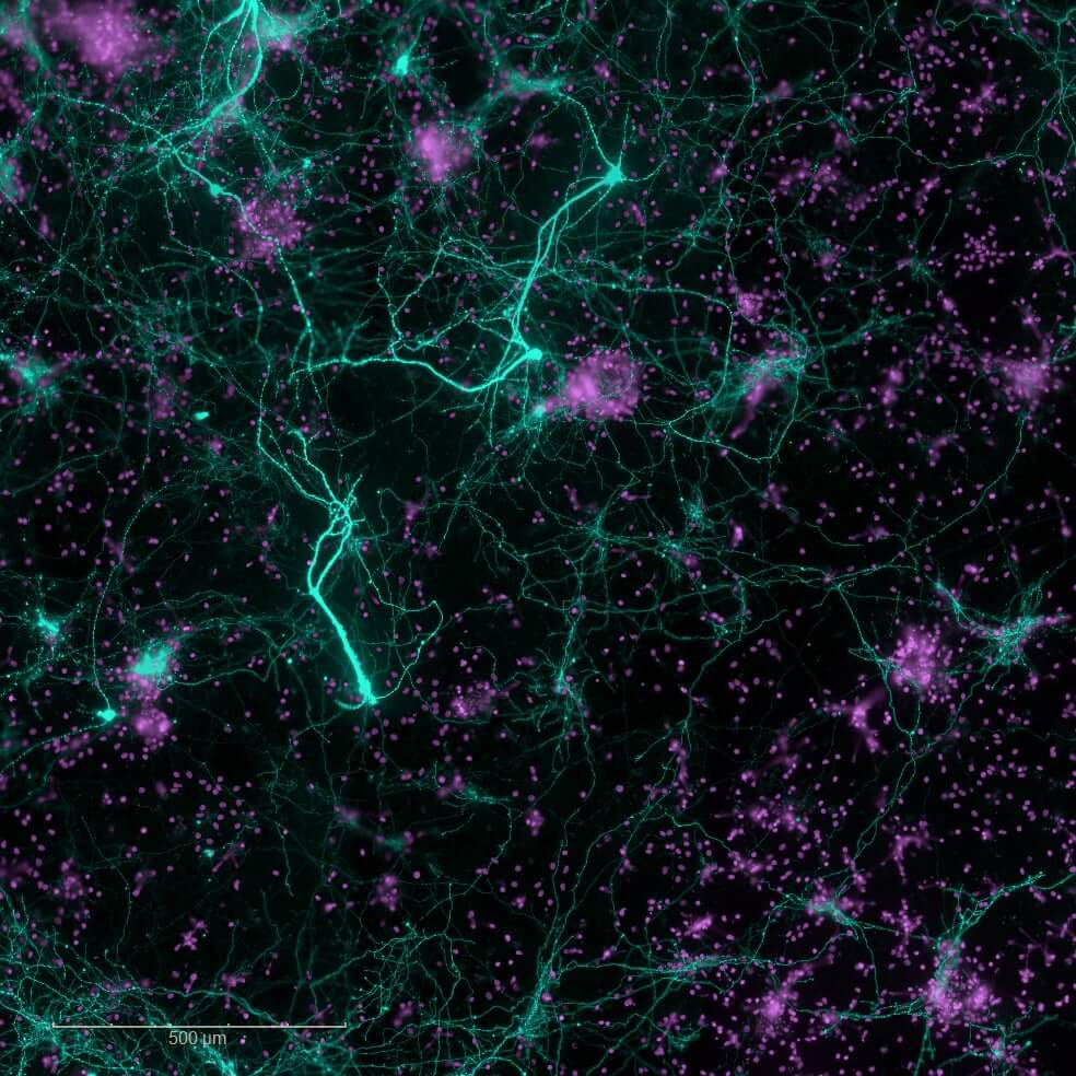 in vitro-dopaminergic neurons-DAPI-TH-Neurodegeneration model- α-synuclein