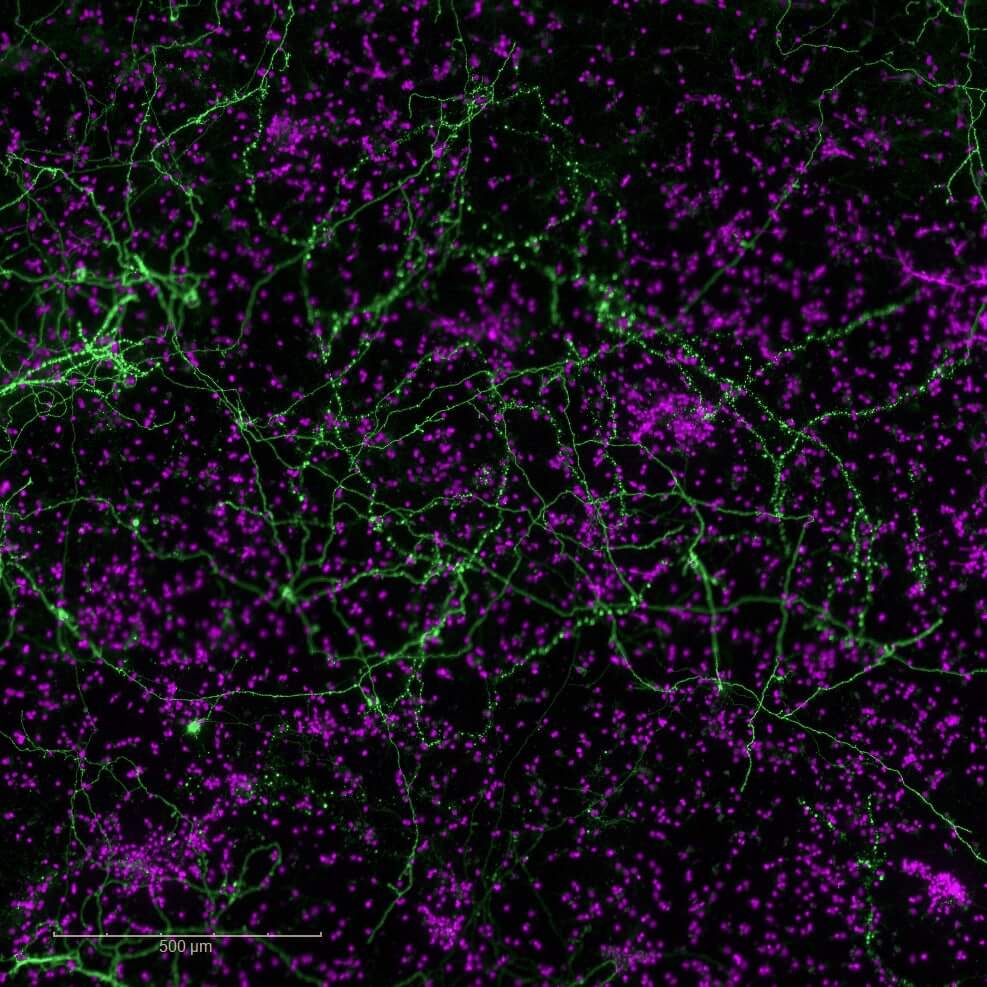 in vitro-dopaminergic neuron-DAPI-et-TH-Neurodegeneration model-6-OHDA