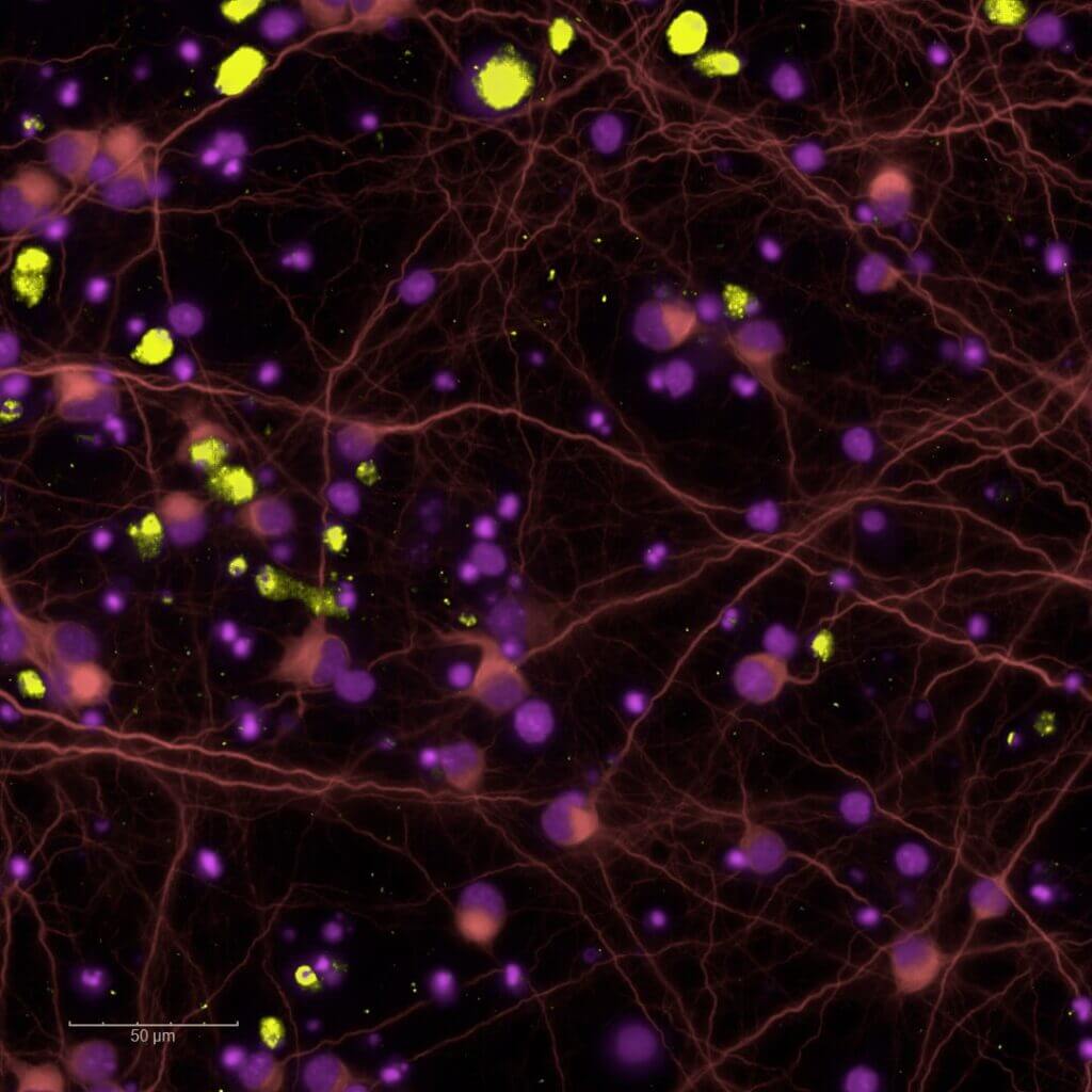 in vitro-Neurons-MAP2+Bassoon+PSD95+DAPI-Neurodeegeneration AB model