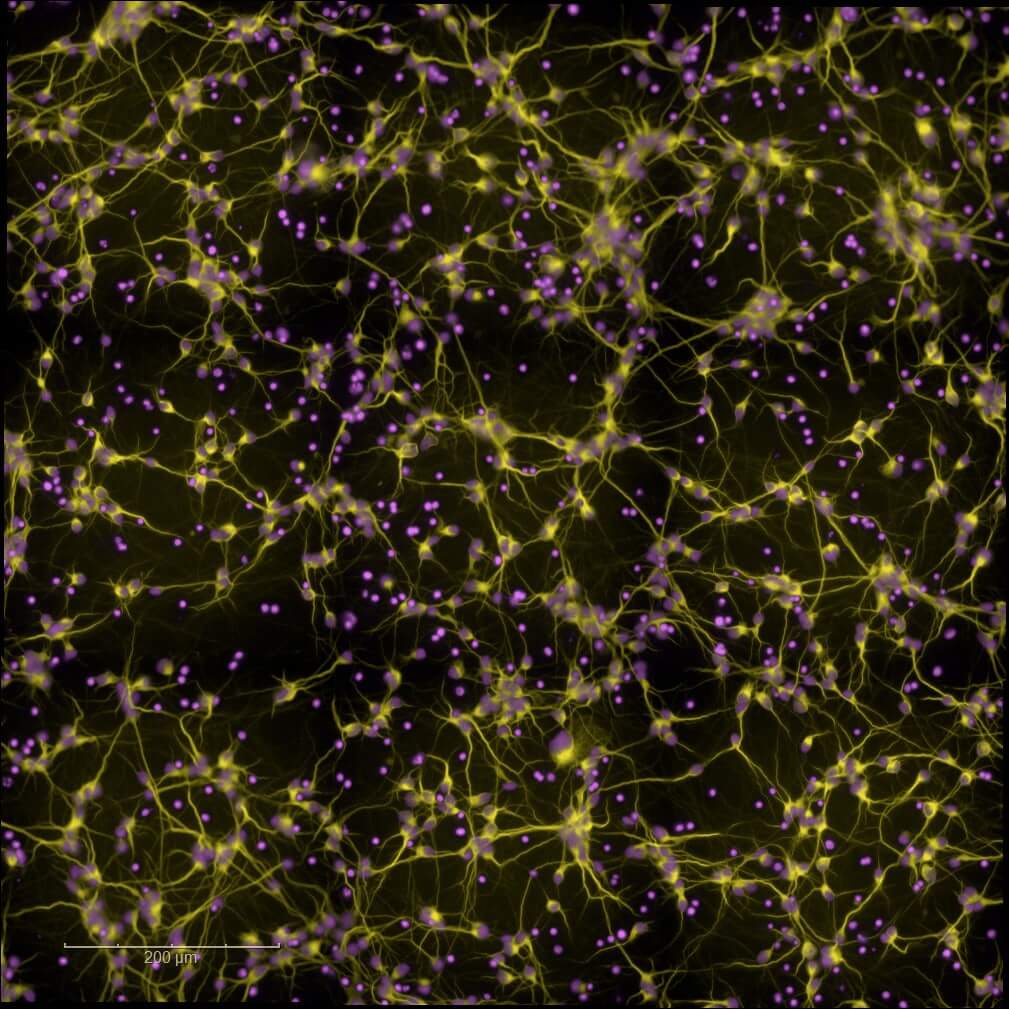 in vitro Neurons-Glutatamatergic-hiPSC-MAP2-et-DAPI