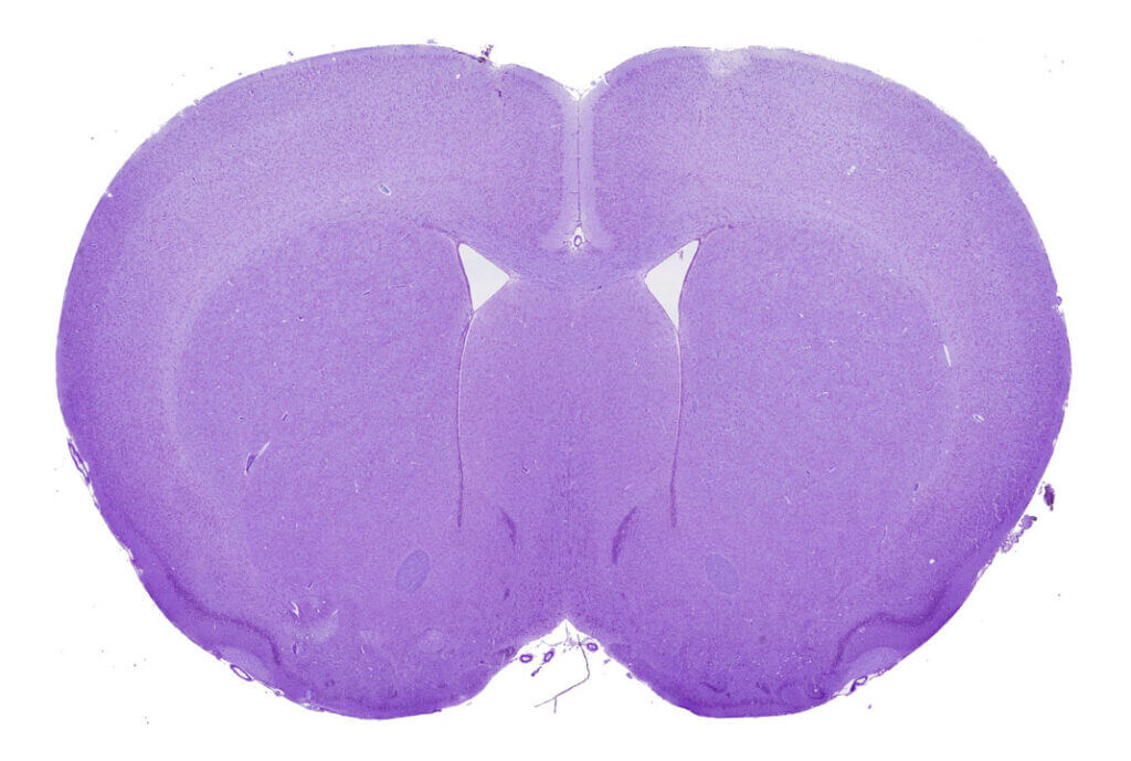 header-strokalliance