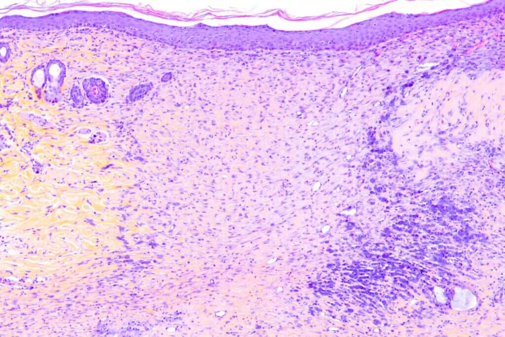 invivo-skin-cicatrisation histology