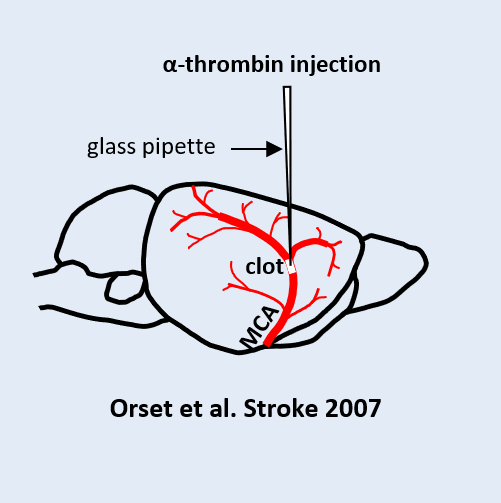 thrombin injection illustation in a rodent brain, showing clot and MCA-blue background