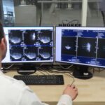 irm live on a screen