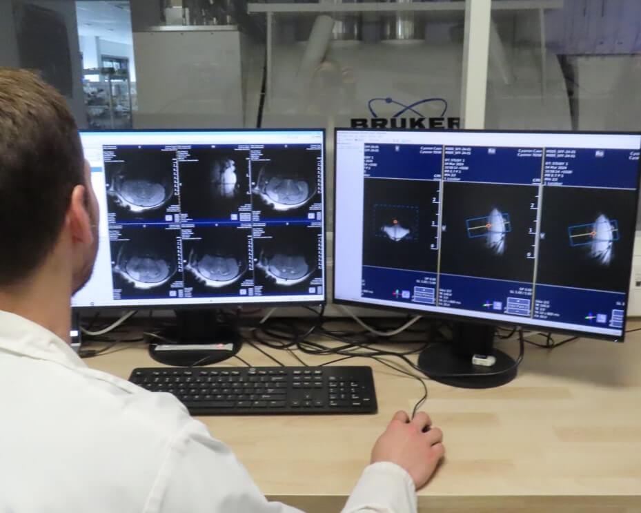 irm live on a screen