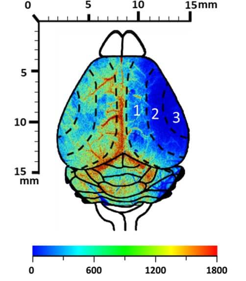 stroke-invivo-imaging-speckle