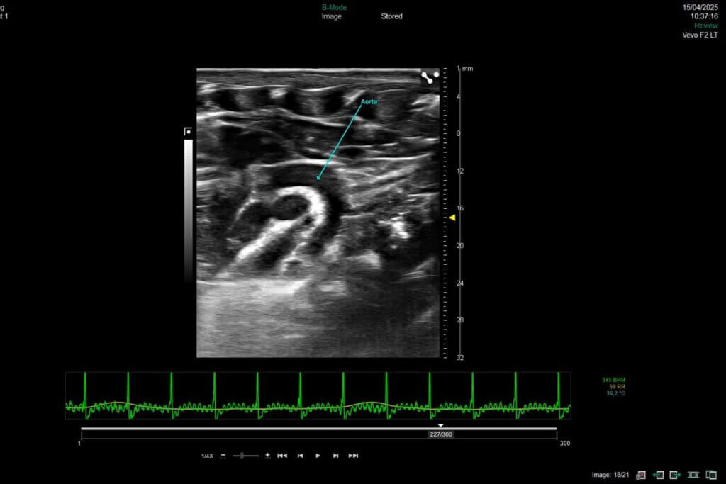 Syncrosome-cardio-IM-heart imaging