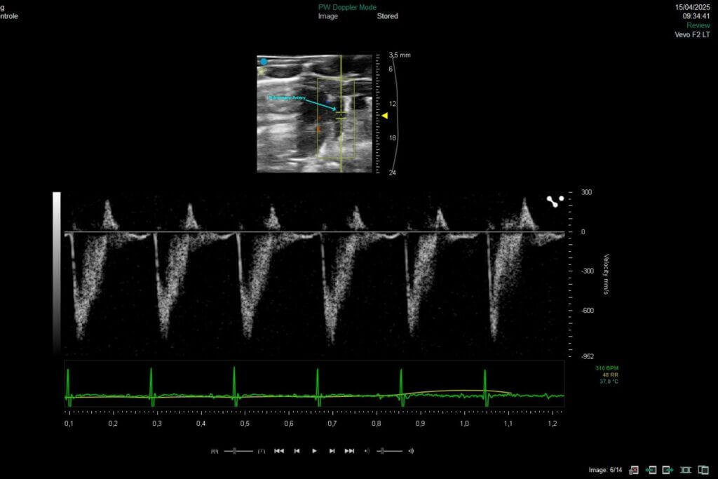 Syncrosome-cardio-PAH-VEVO-heart imaging
