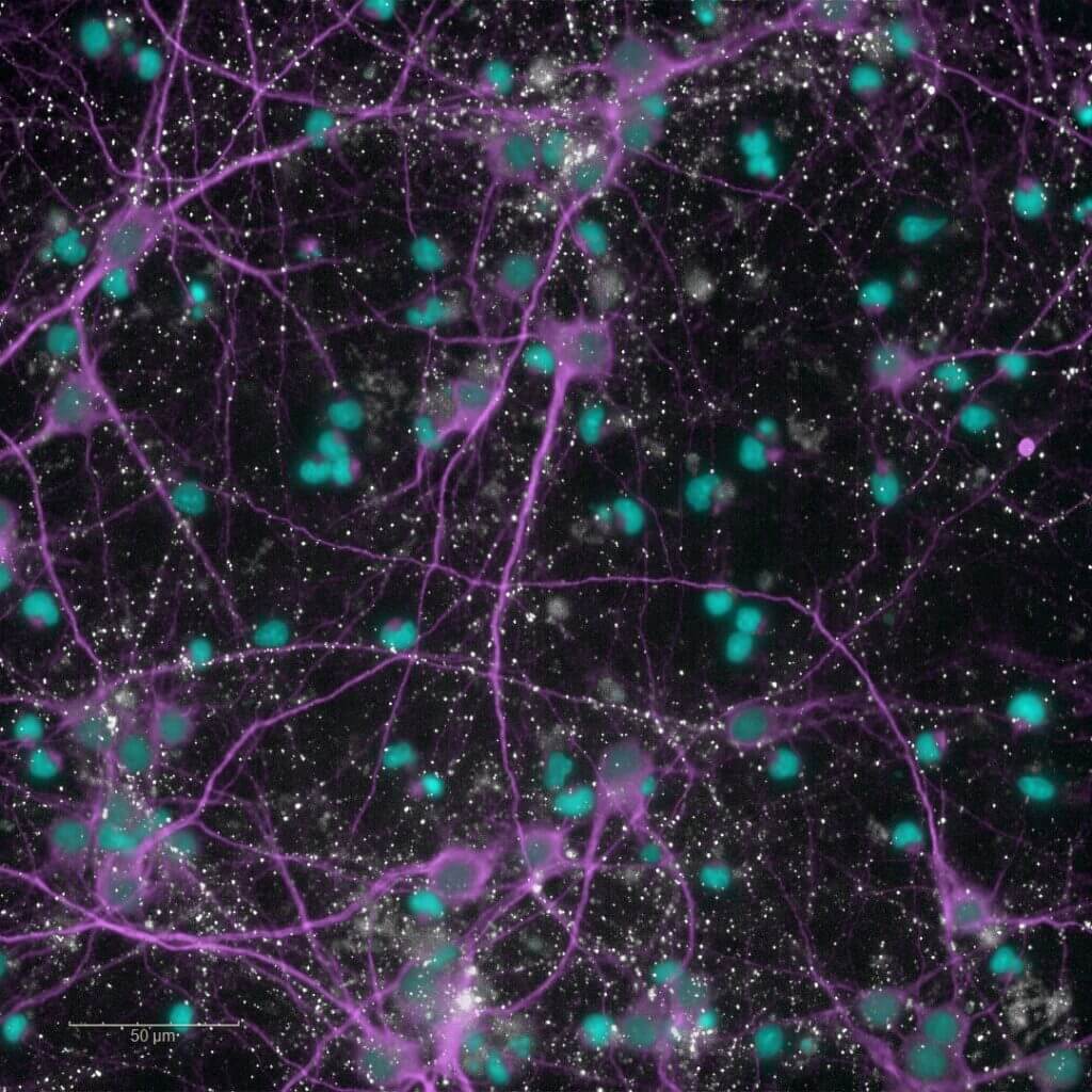 result of toxicity induced by glutamate on 2D in vitro culture
