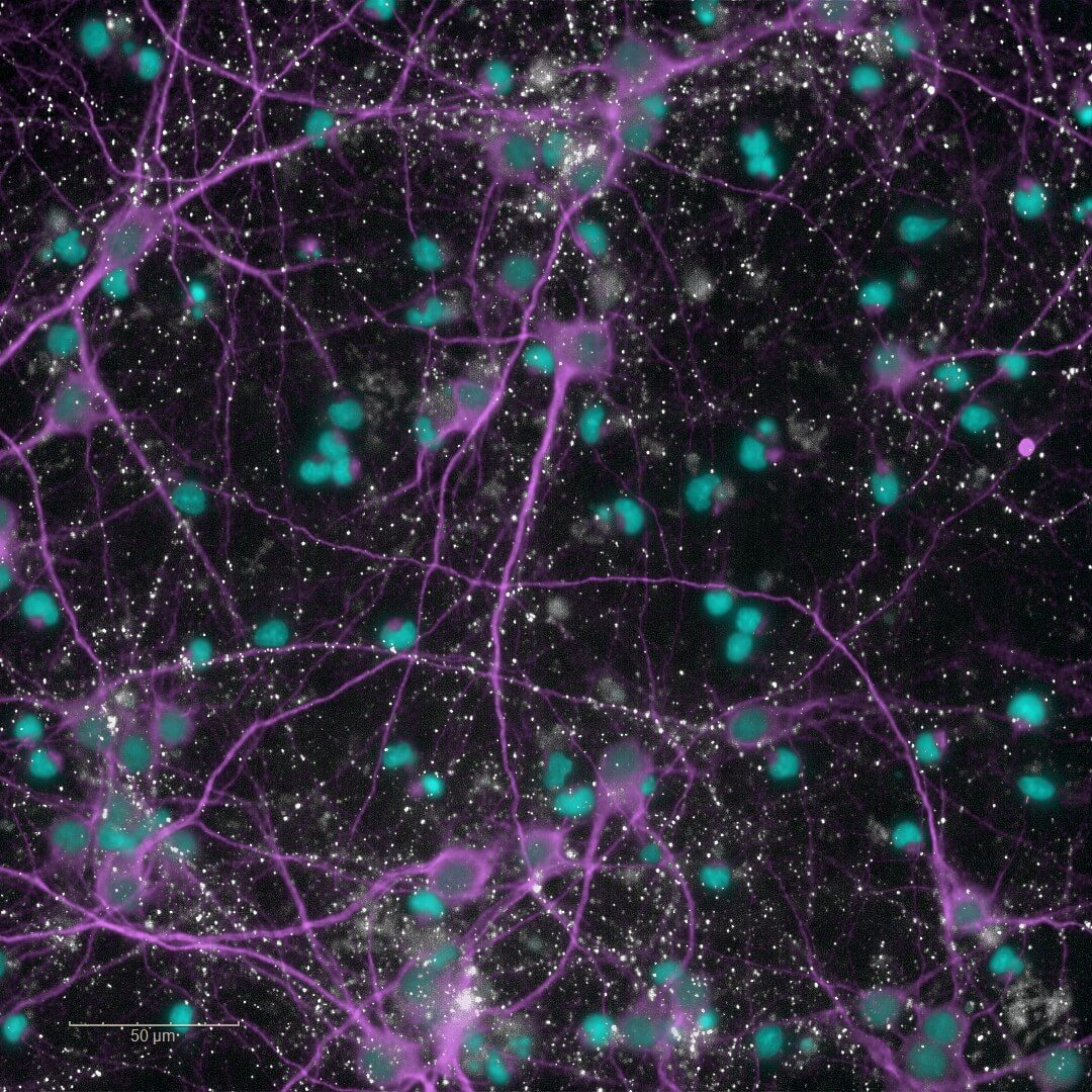 Toxicité induite par le glutamate : culture 2D