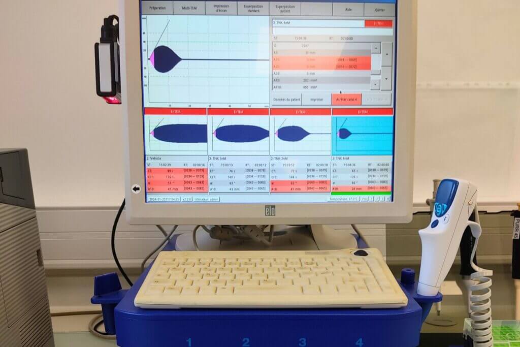 invitro-screen displaying rotem test