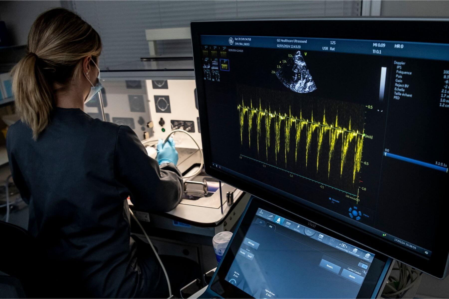 invivo-imaging-echography-cardiology