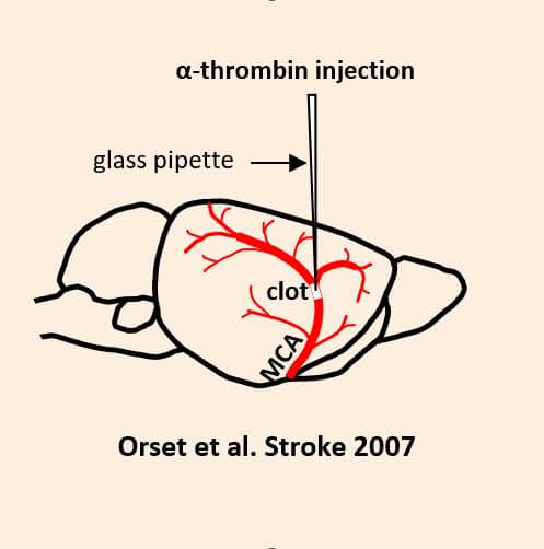 thrombin injection illustation in a rodent brain, showing clot and MCA-orange background