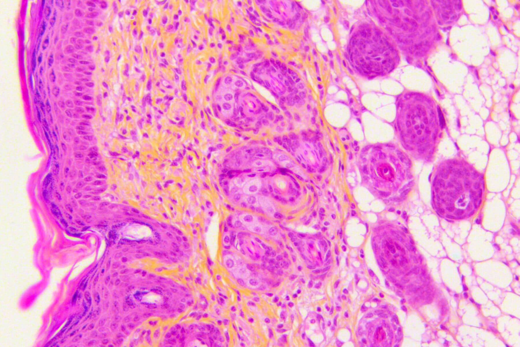 Dermatology – sax transp