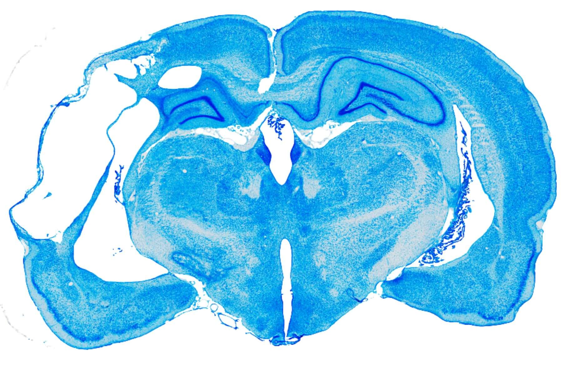 Neurovascular & Stroke – stk header main cresyl stroke