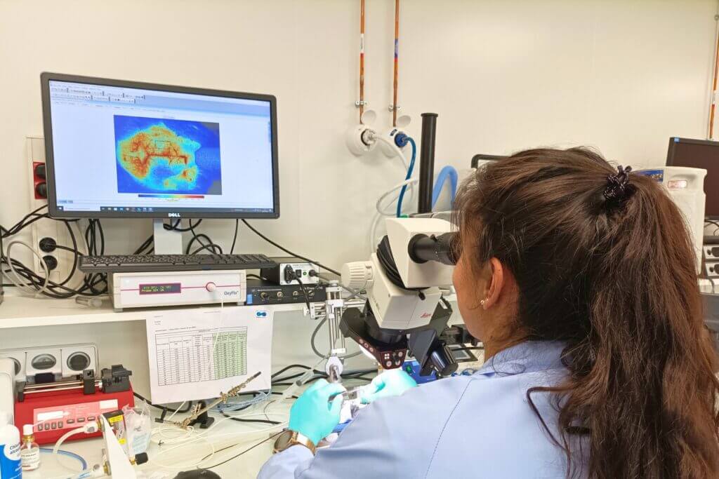 stroke-invivo imaging-speckle