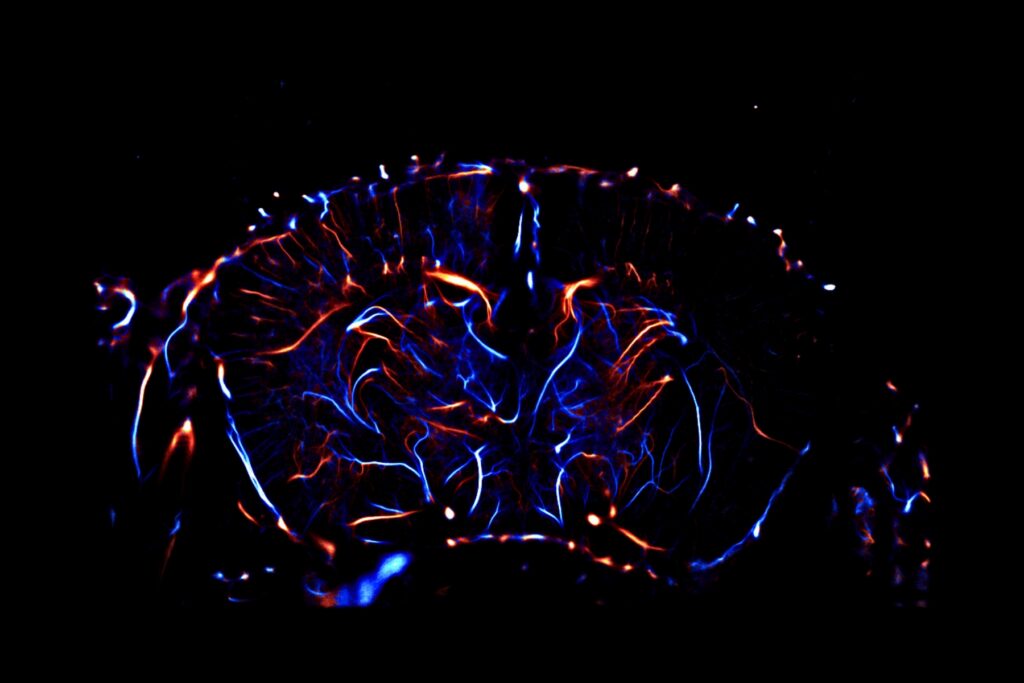 stroke-invivo imaging-fus