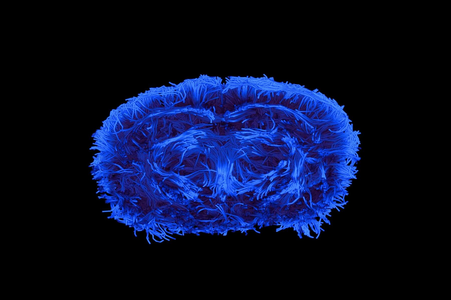 Working with us – stroke invivo tracto