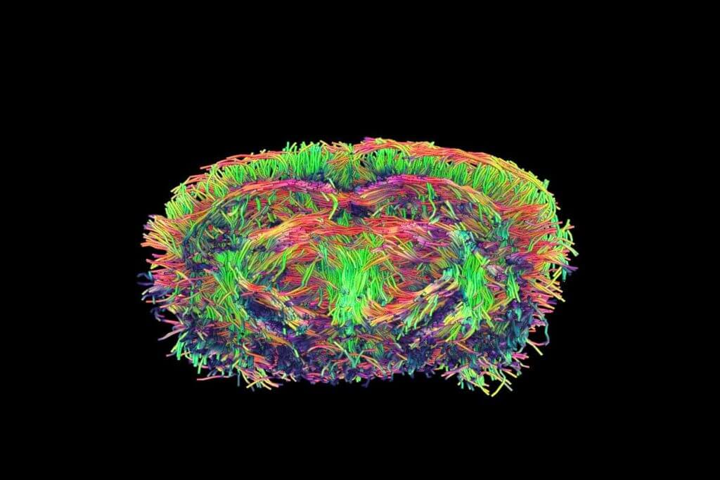 stroke-invivo-tracto imaging in mouse
