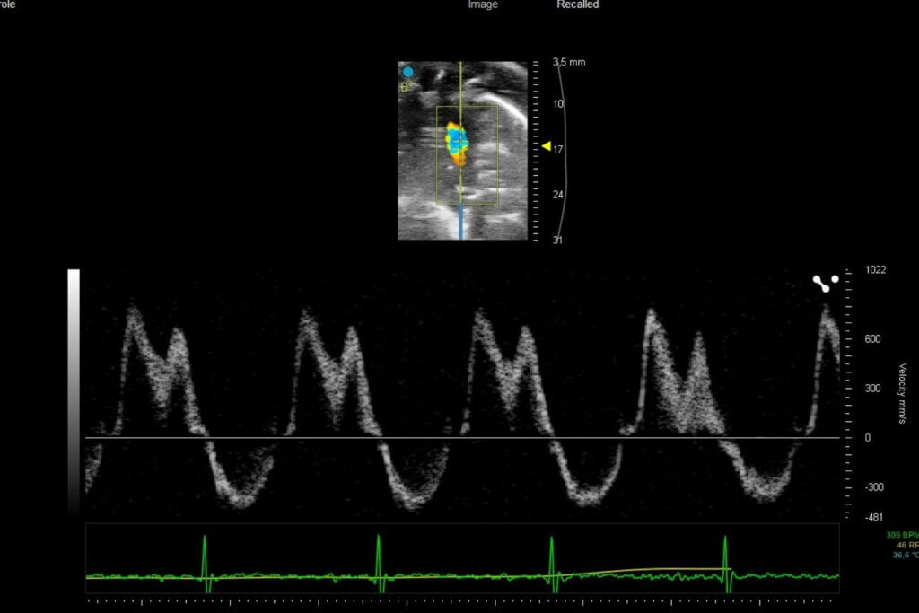 hfpef model -cardiology- in vivo left heart imaging