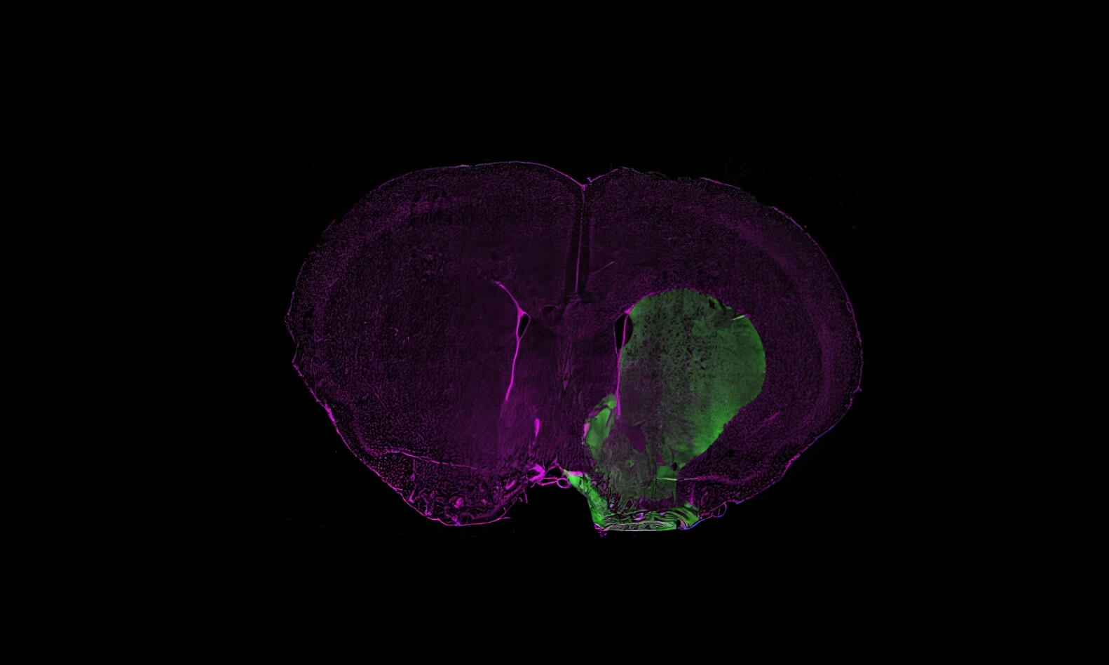 in vivo result on Parkinson 6-OHDA purple green
