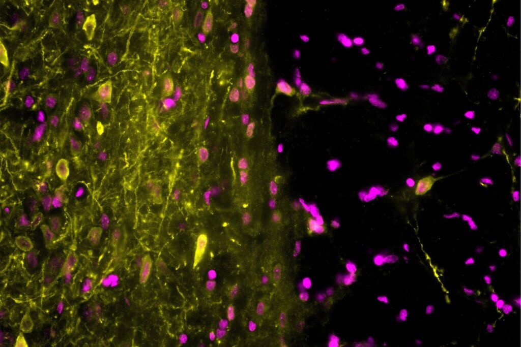 Preclinical results on Neurodegenerative diseases model