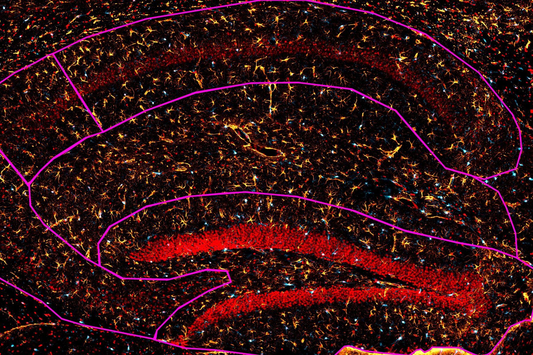 neurology Immunohistology fluorescent results