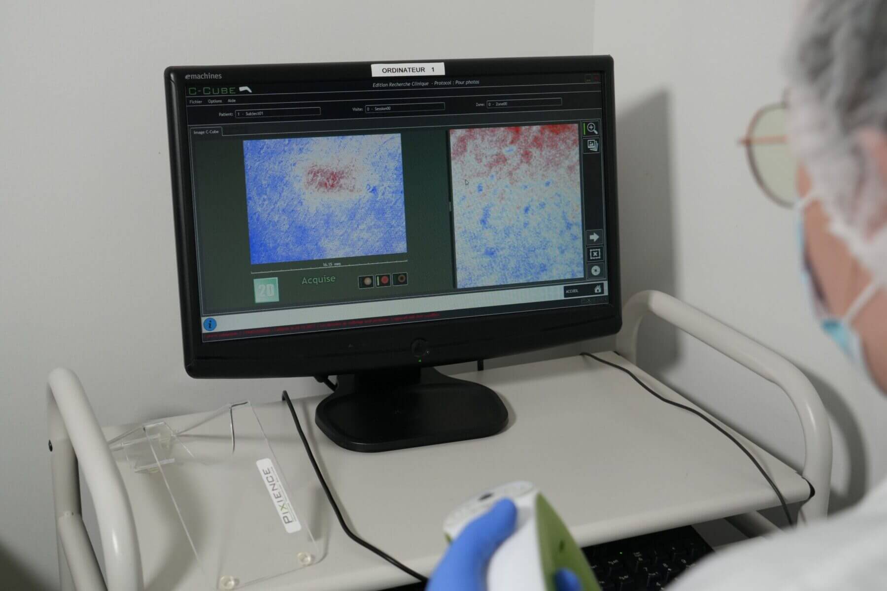 Dermoscope imaging on screen with c-cube technology