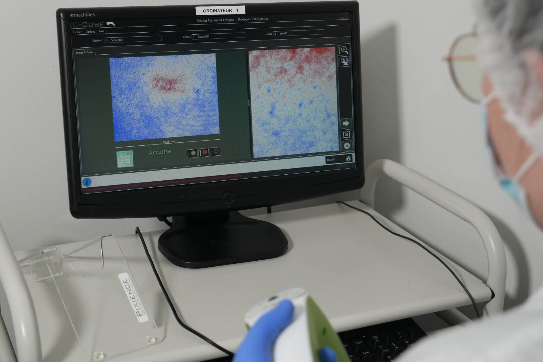 Dermoscope imaging on screen with c-cube technology