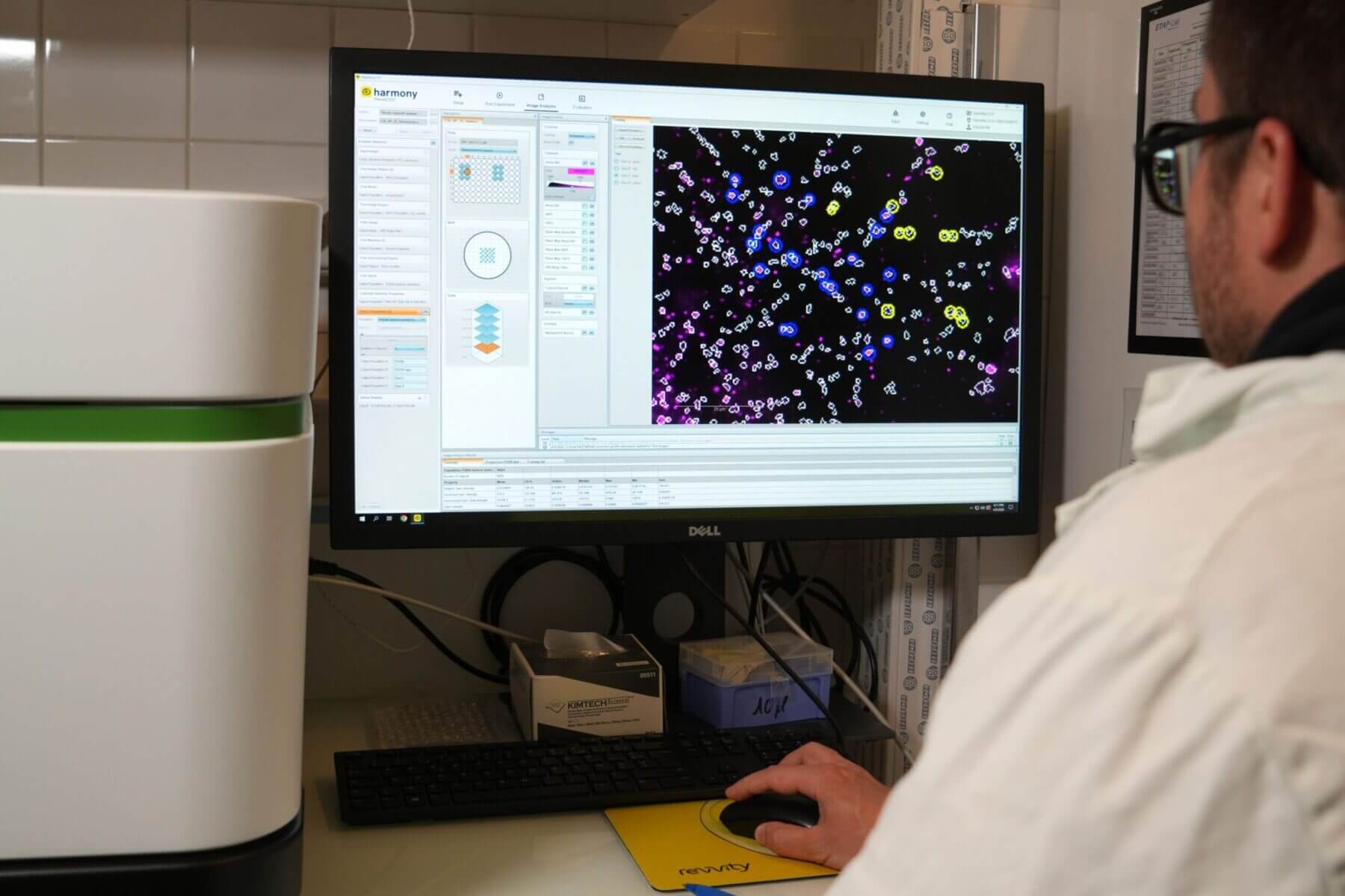 people looking at a screen with high content imaging of in vitro results