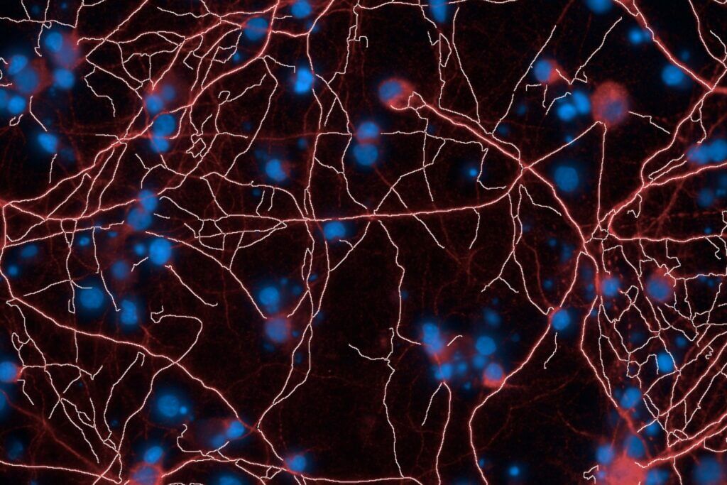 high content imaging of in vitro results
