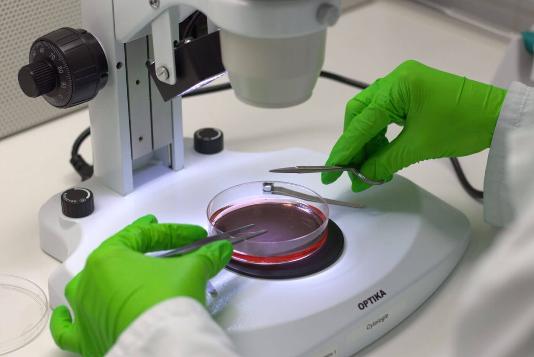 people at In Vitro Lab Cell Culture - hands handling Lens Device