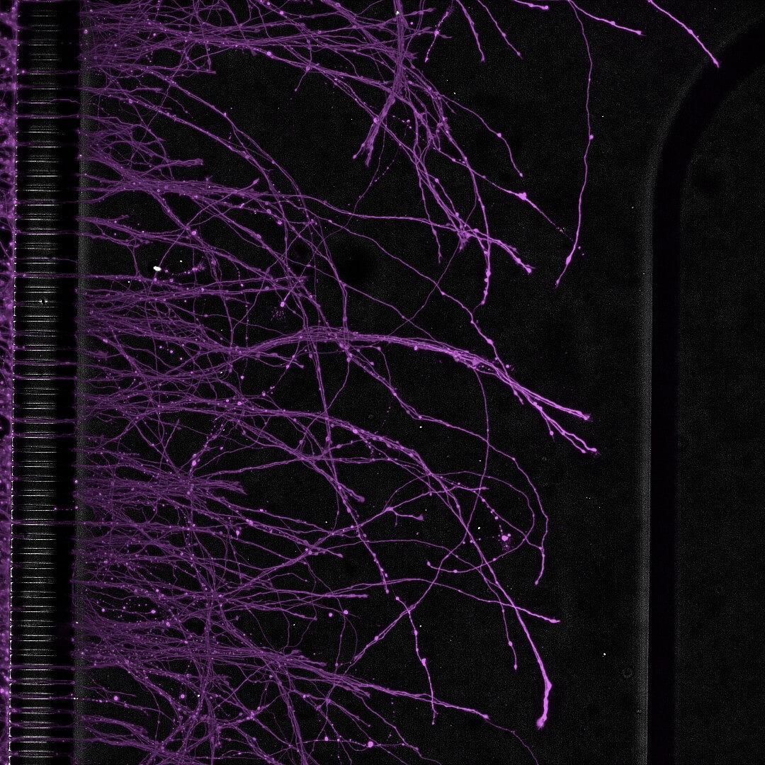 in Vitro Microfluidic result on neurology brain on chips