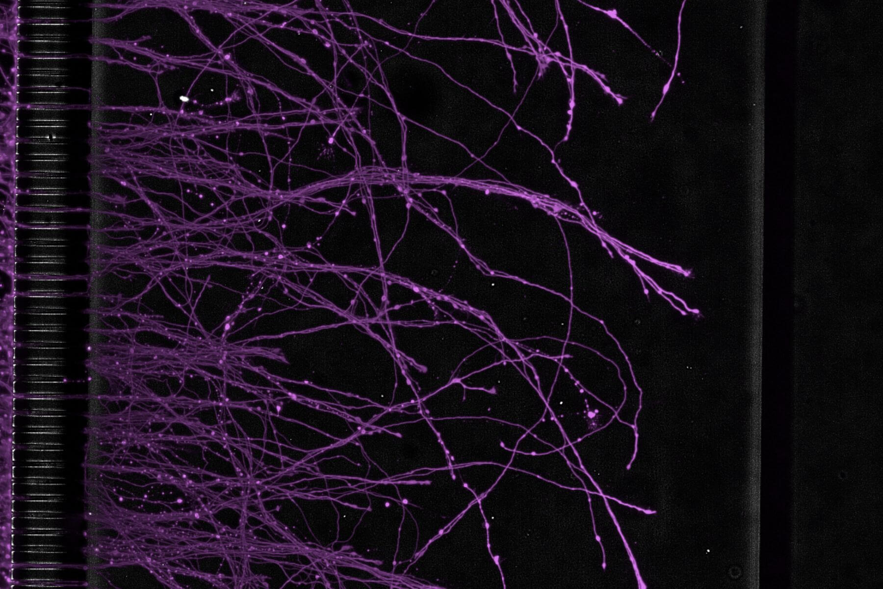 in Vitro Microfluidic result on neurology brain on chips