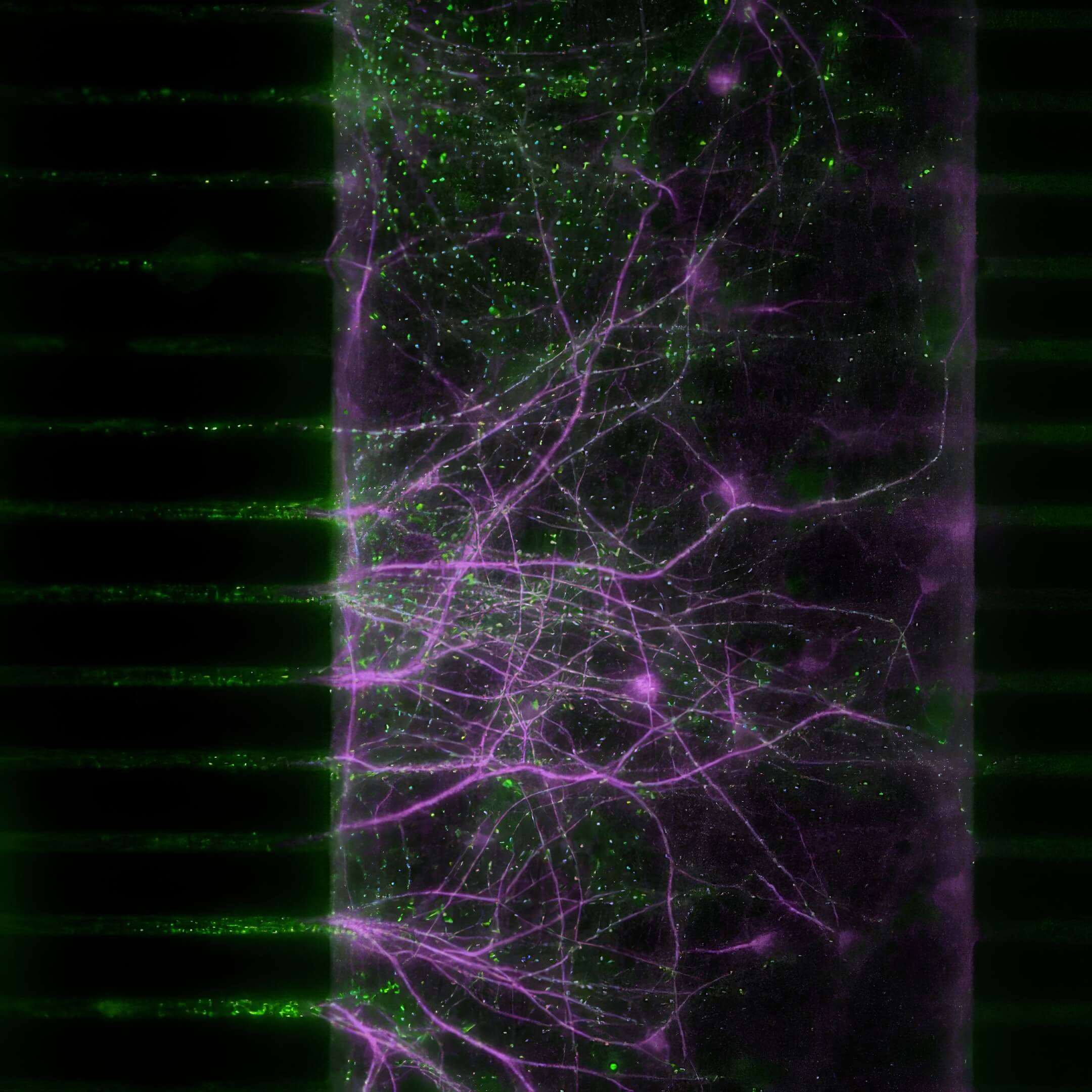 in Vitro Microfluidic result on neurology brain on chips