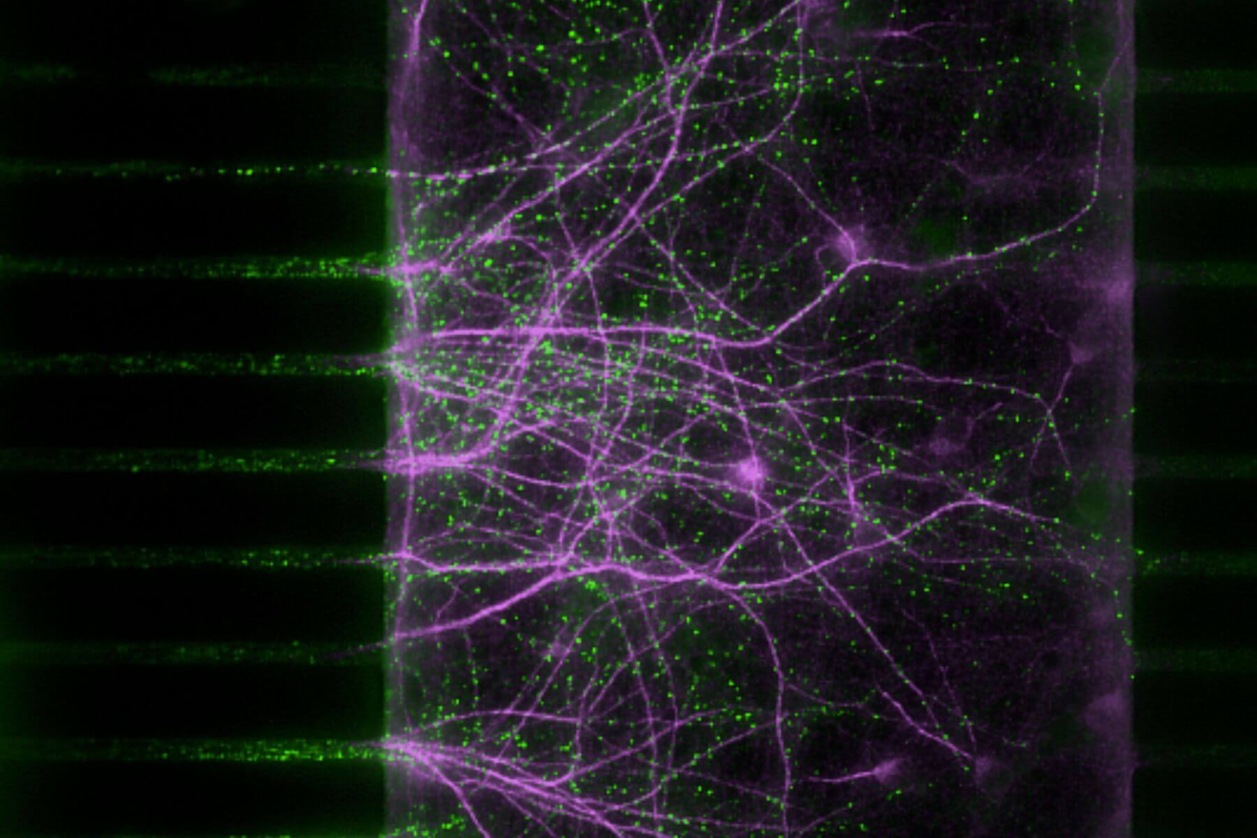 in Vitro Microfluidic result on neurology brain on chips