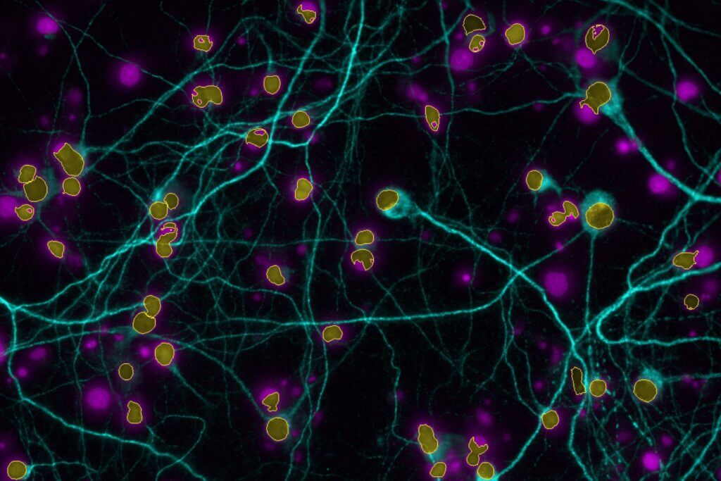 high content imaging results neurology