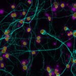 high content imaging results neurology