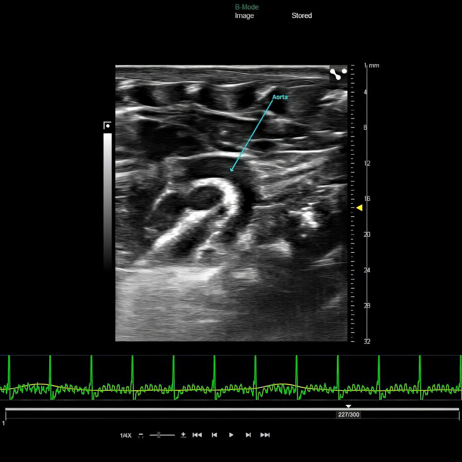 cardiology in vivo imaging -IM heart